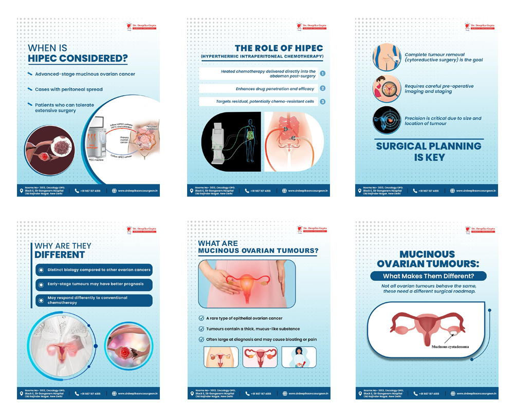 Mucinous ovarian tumours Surgery